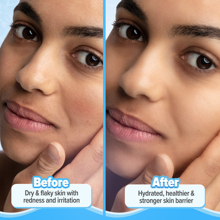 Before-and-after panel showing barrier repair moisturizer results