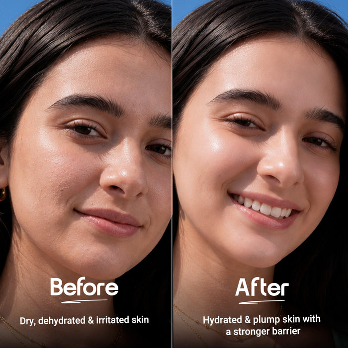 Barrier+ Hydra Melt Gel Moisturizer with  2% Cera-Hyaluron Complex™ & Avocado - 200 g