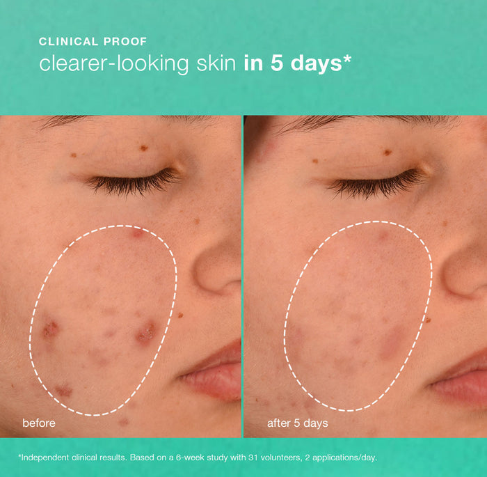 Breakout Biotic Moisturiser