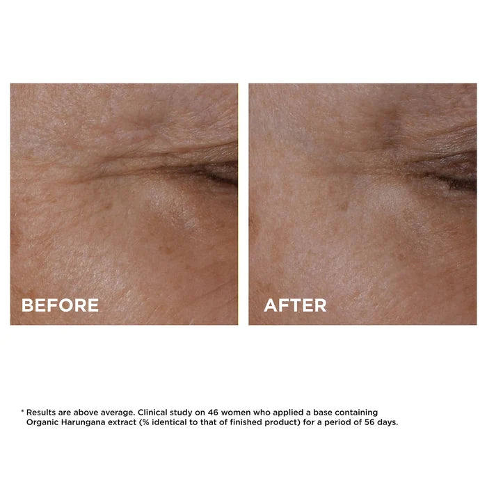 Clarins Total Eye Lift firming and smoothing anti-aging eye cream in 15ml jar, showing the product container and label.