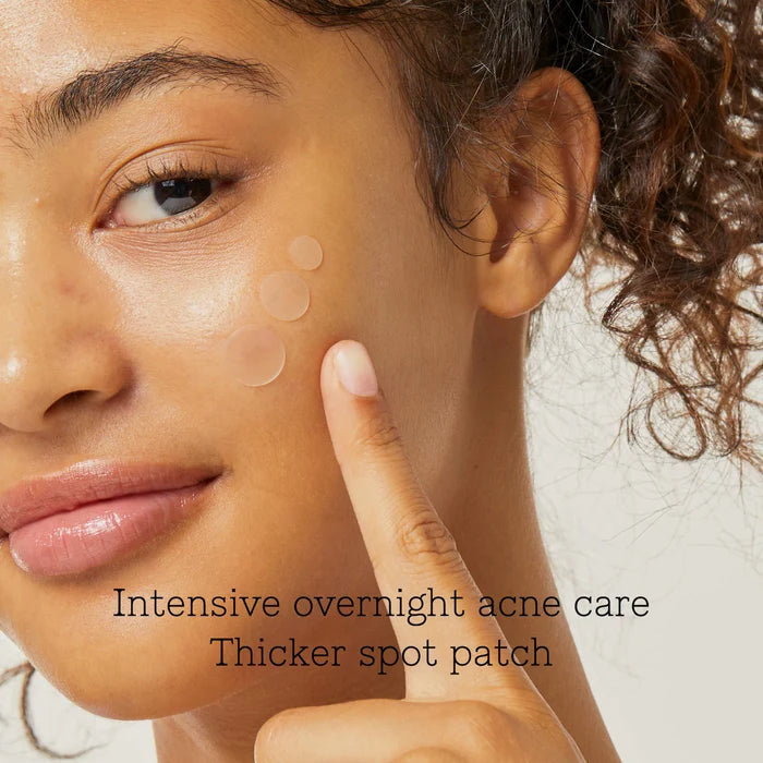 Cosrx Acne Pimple Master Patches applied to skin, showing clear, round patches designed for acne treatment and skin care.