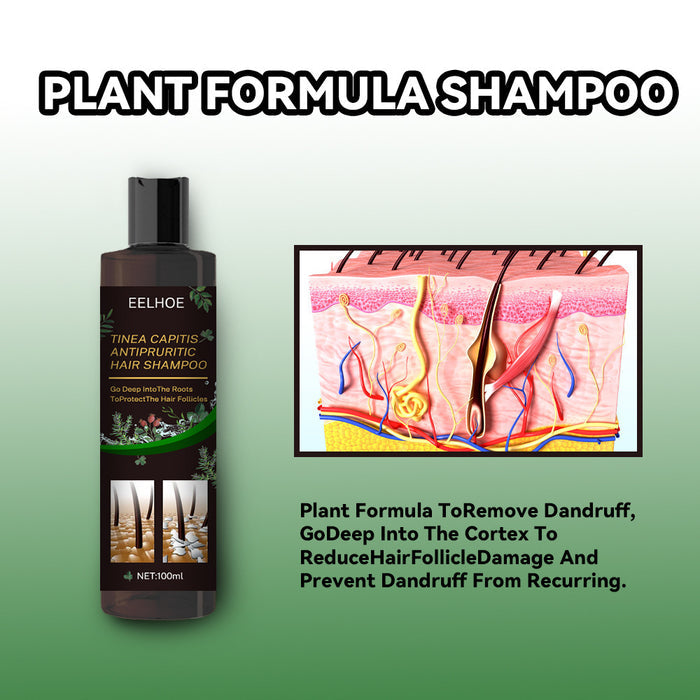 EELHOE Anti Dandruff Shampoos & Stop Itching EELHOE COSMETICS