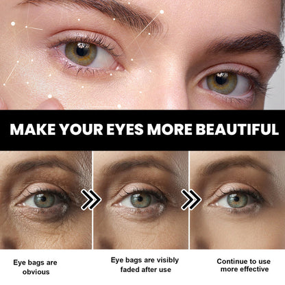 EELHOE Dark Circles Eye Cream – Fade Wrinkles, Eye Bags & Dark Circles EELHOE COSMETICS