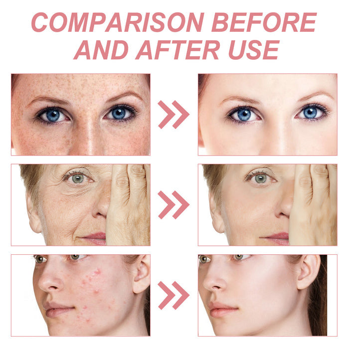 EELHOE Facial Care Gentle Cleansing And Hydrating Moisturizing Skin Repair Firming EELHOE COSMETICS