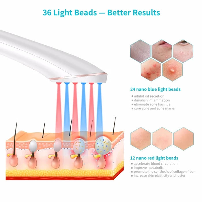 EELHOE Wireless Acne Red Light Therapy Device – Blue & Red LED Acne & Imperfections Eraser EELHOE COSMETICS