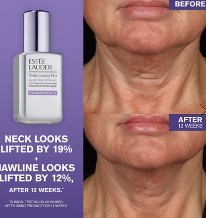 Estee Lauder Perfectionist Pro Rapid Firm + Lift Serum with hexapeptides, 30ml bottle, featuring a sleek skincare packaging design.