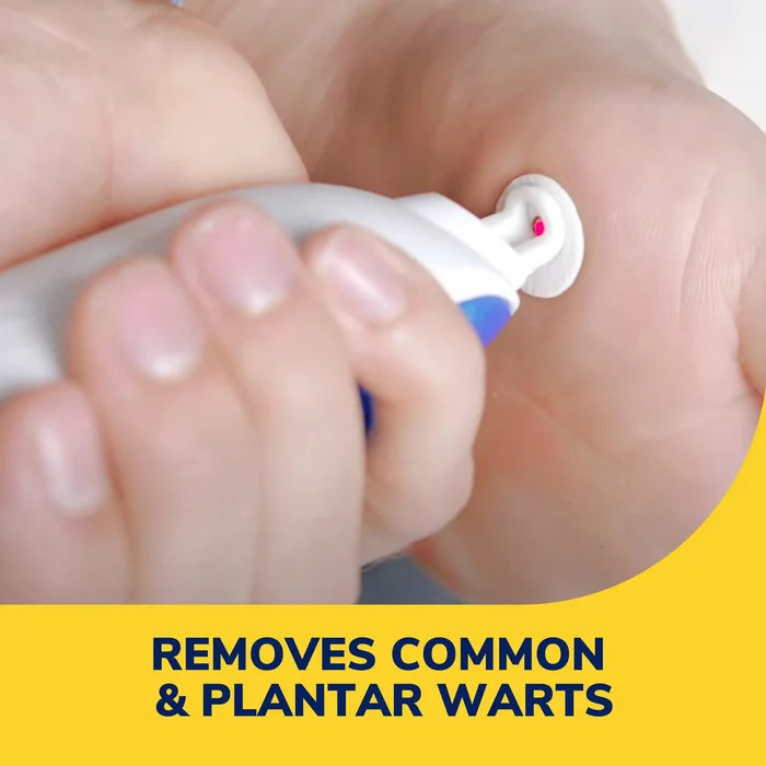 Freeze Away Max™ wart remover precision applicator spray tip near foot