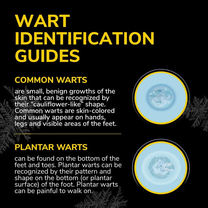 Freeze Away Max™ wart identification guide with illustrated wart examples