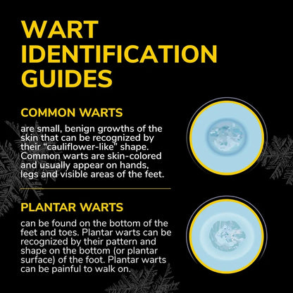 Freeze Away Max™ wart identification guide with illustrated wart examples