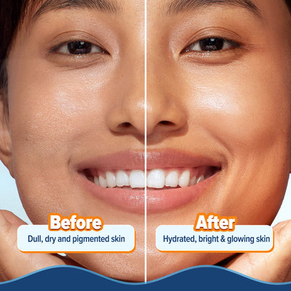 Before-and-after panel showing a fresher, hydrated skin look