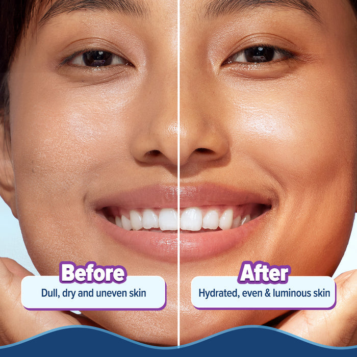 Before and after skin comparison with smoother hydrated finish