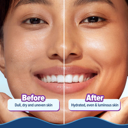Before and after skin comparison with smoother hydrated finish