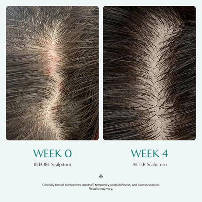 Lilyeve Scalp: Turn Cica PDRN Brush Ampoule 100ml ليلييف سكالب: أمبولة فرشاة تيرن سيكا بي دي آر إن - Princess Cosmetics Qatar