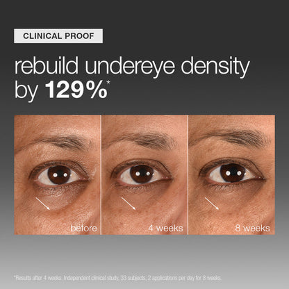 smart eye density