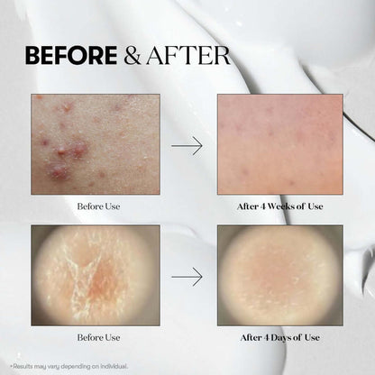 VGLE Beauty Bundle - Texture Reset Combo – Bundles | Korean Skincare Canada - VGLE Beauty