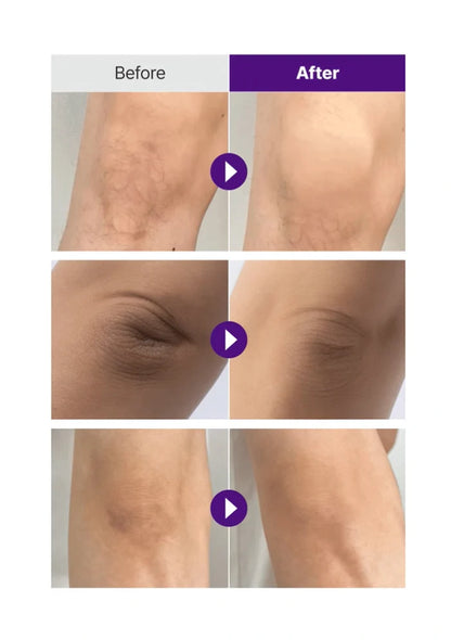 Before and after comparison of skin treatment on different body parts.