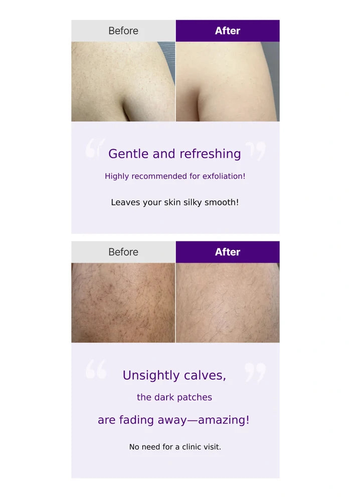 Before and after skin treatment results with a focus on calve dark patches fading away.